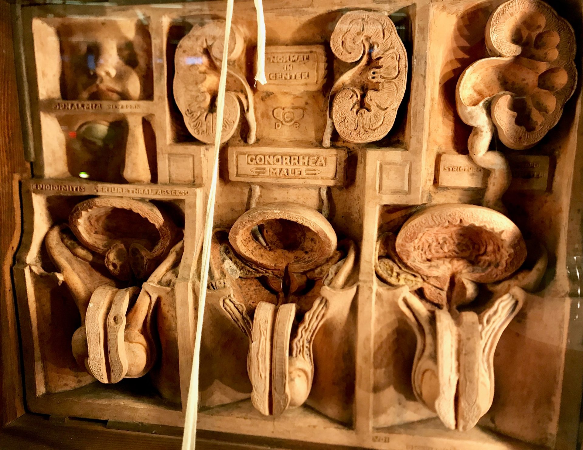 Dickinson-Belskie Collection, Warren Anatomical Museum, Boston (by Luca Ambrosio) (3).jpg
